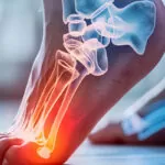 How to Find Relief for Foot Pain with Physical Therapy This Spring